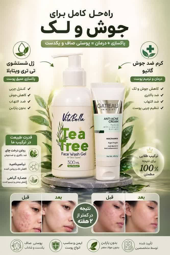 پک زد جوش